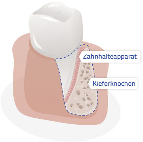 parodontologie zahnhalteapparat